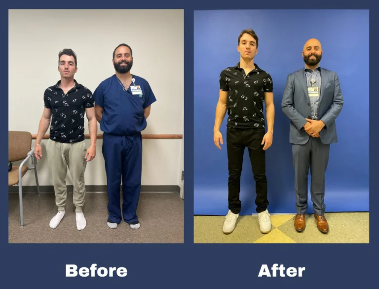 A before picture of a young man, Mark, with Dr. Assayag where Mark is shorter than the doctor, and an after lengthening picture where Mark is taller than Dr. Assayag