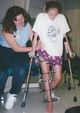 Carly at eleven in above-and below-knee external fixators getting assistance from another woman while walking with crutches