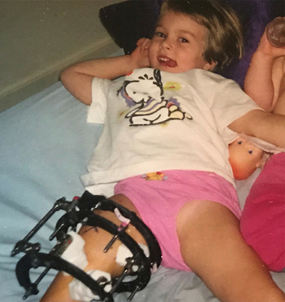 Emily as a very young girl lying back on a bed with an external fixator on her leg