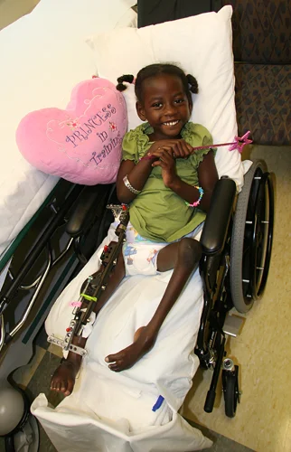 Melissa as a young child in a wheelchair with an external fixator on one leg