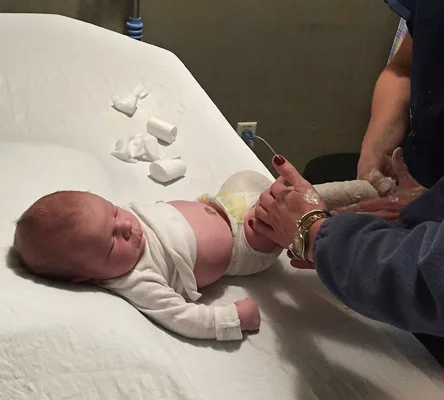 Cannon as an infant getting casts put on