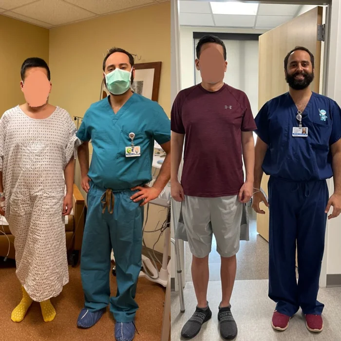 Dr. Michael Assayag standing next to a cosmetic limb lengthening patient before and after treatment