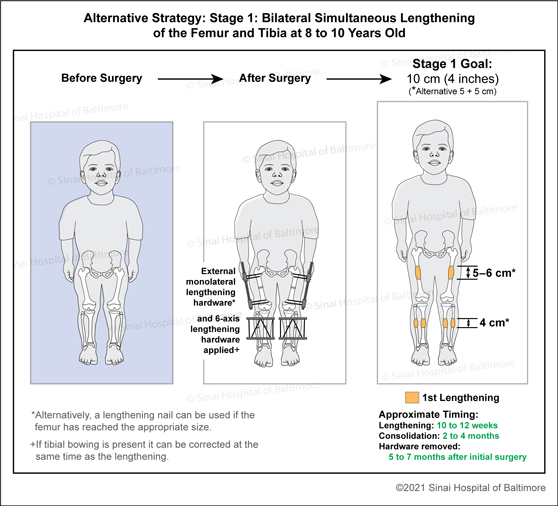 hypopituitary dwarfism vs achondroplasia