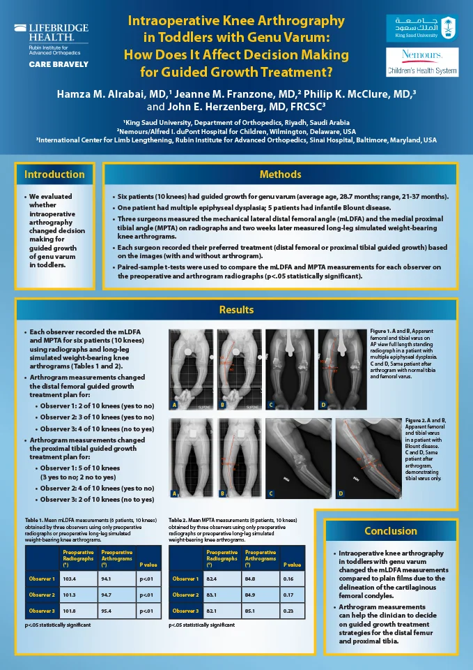 Research poster presented at the 4th Combined Congress of the ASAMI-BR & ILLRS Societies in Liverpool, UK in August 2019 - Intraoperative Knee Arthrography in Toddlers with Genu Varum - How does it affect decision making for guided growth treatment