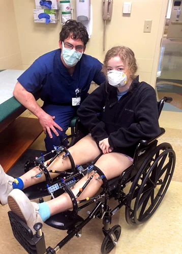 Dr. McClure sitting by Bridget in a wheelchair wearing external fixators on both legs