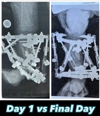 Joey’s before and after X-rays