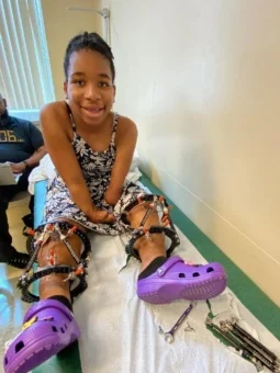 Kennedee on a clinic exam table wearing external fixators