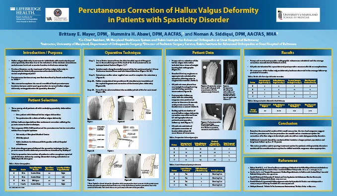 Research poster presented at the Annual Meeting of the American College of Foot and Ankle Surgeons in New Orleans, Louisiana in February 2019 - Percutaneous Correction of Hallux Valgus Deformity in Patients with Spasticity Disorder