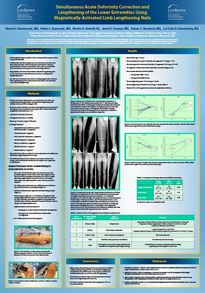 Research poster presented at the ILLRS and ASAMI Congress and 3rd World Ortho ReCon Meeting in Lisbon, Portugal in August/September 2017 - Simultaneous Acute Deformity Correction and Lengthening of the Lower Extremities Using Magnetic Limb Lengthening Nails